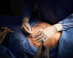 Cirurgia Plástica e Reconstrutiva – Prof Ricardo Cavalcanti