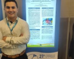 Side-to-side choledochoduodenostomy as an alternative treatment for choledocholithiasis: case report