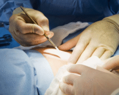 Cirurgia Geral – Prof Moacyr Simas Moreira