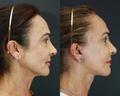 Cirurgia Plástica da Face